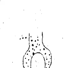 Figure for question 38