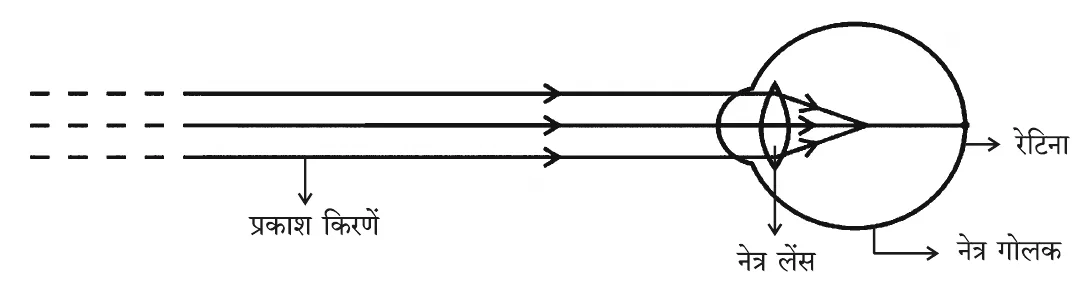 Figure for question 25