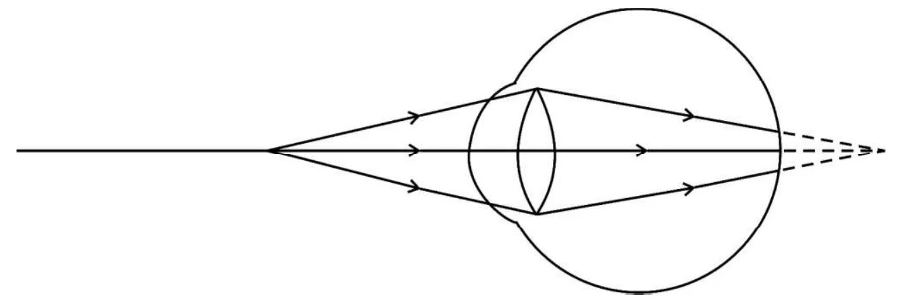 Figure for question 25