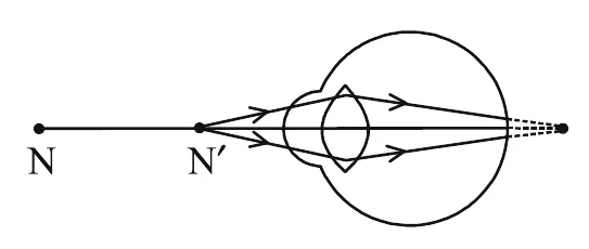 Figure for question 31