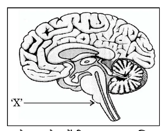 Figure for question 9